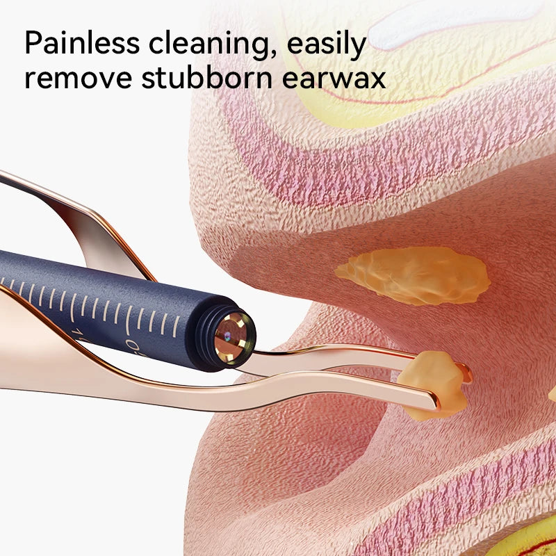HD Ear Wax Cleaner Camera