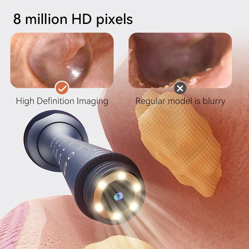 HD Ear Wax Cleaner Camera